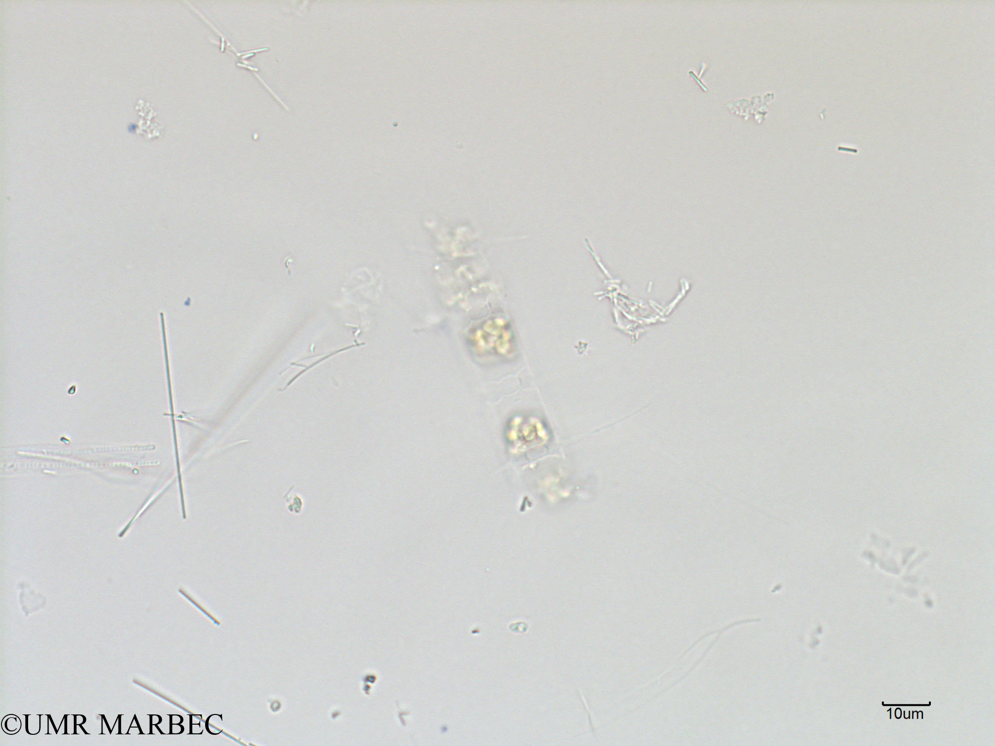 phyto/Scattered_Islands/iles_glorieuses/SIREME May 2016/Bacteriastrum furcatum (ancien Bacteriastrum sp10 -SIREME-Glorieuses2016-GLO6surf-271016-Bacteriastrum spb-5)(copy).jpg
